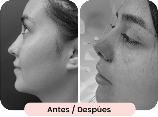 Img-2-carousel_1-min